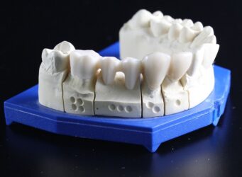 dentures vs implants moreno valley