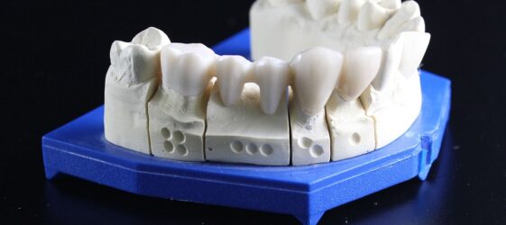 dentures vs implants moreno valley